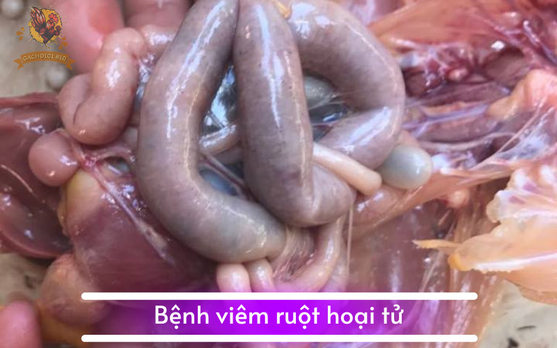 Bệnh viêm ruột hoại tử